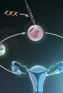 F套餐 定制宝宝助孕包成功85万